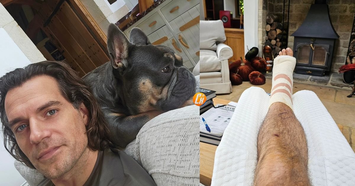 Henry Cavill teilte seinen Welpen mit, dessen Pfote nach dem Vorfall während der | Cinexcepción