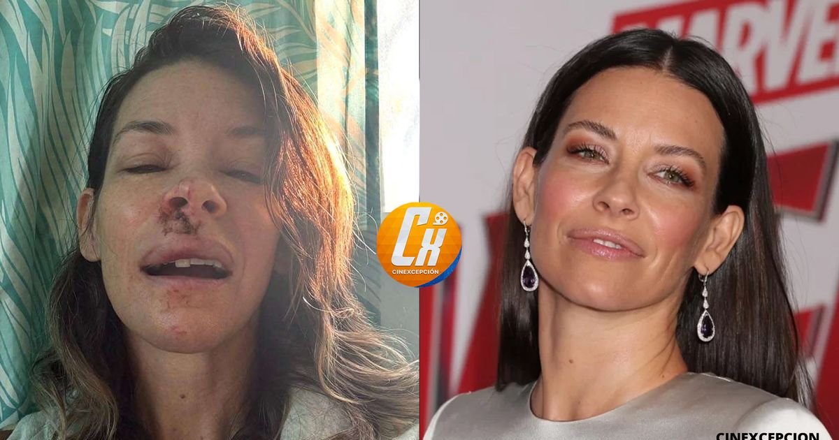 #EvangelineLilly hat einen Hirnschaden. | Cinexcepción