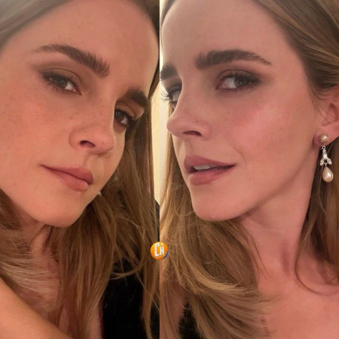 Fotitos recién compartidas de Emma Watson. | Cinexcepción